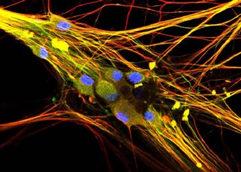 MIT Study Reveals Connection Between COVID-19 and Impaired Sensory Neurons