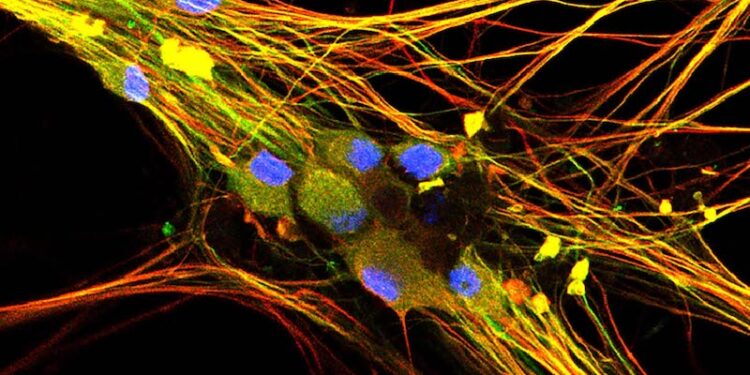 MIT Study Reveals Connection Between COVID-19 and Impaired Sensory Neurons