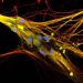 Neanderthal Genes Are Linked to Severe COVID Risk
