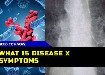 Disease X is a potential new pandemic that could be as devastating as the Spanish Flu