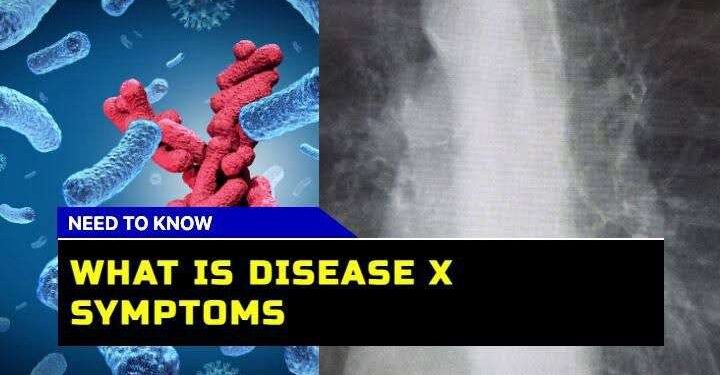 ‘Disease X’ – Experts Warn of a Potential Pandemic 20 Times Deadlier Than COVID-19