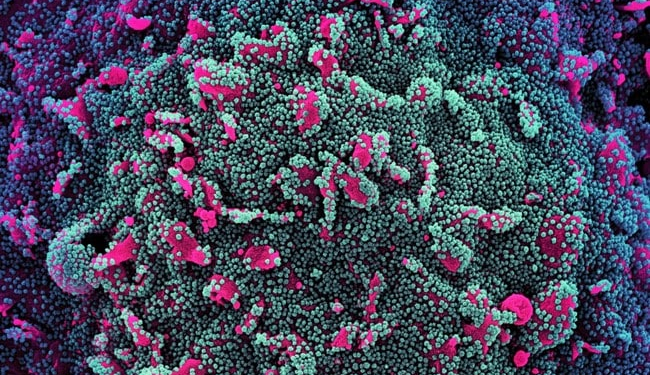 Pirola Variant Emerges: Dangerous New COVID Strain Raises Concerns in South Australia