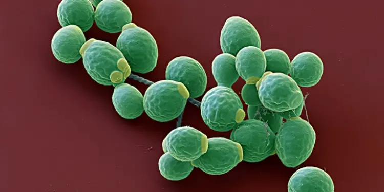 Inflammatory Response in Severe COVID Linked to Elevated Gut Fungi Levels