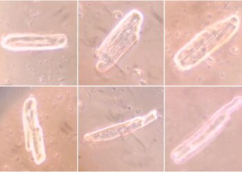 mRNA COVID Vaccines Form Spike Protein in Heart Cells, but Cause Different Anomalies: Research Article