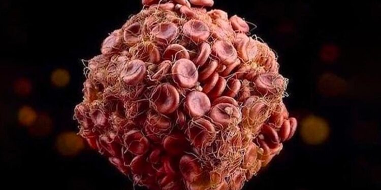 New Research Offers Insights Into Fatal Blood Clots After COVID Vaccination