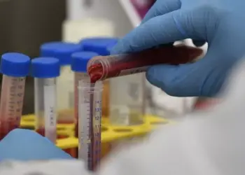 Urgent Alert: People Experiencing Severe Illness from a Mystery Flu Resembling Covid