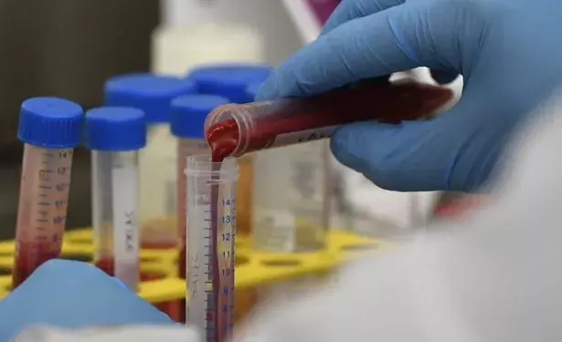 Urgent Alert: People Experiencing Severe Illness From a Mystery Flu Resembling COVID