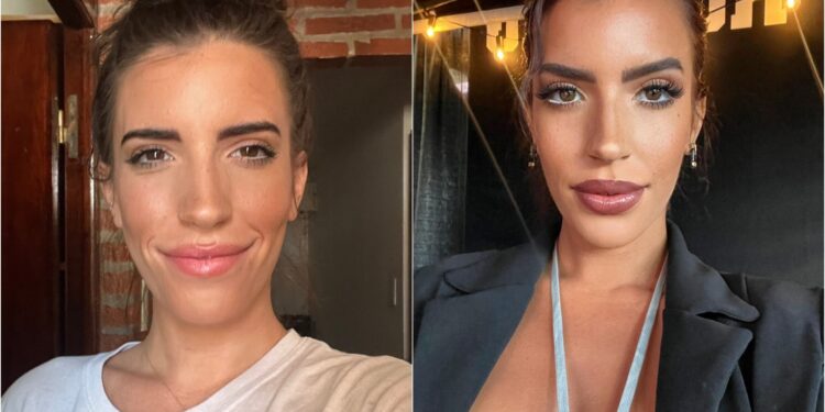 Young Professional’s Heart Problem Possibly Linked to COVID-19 Vaccine, Cardiologists Suggest